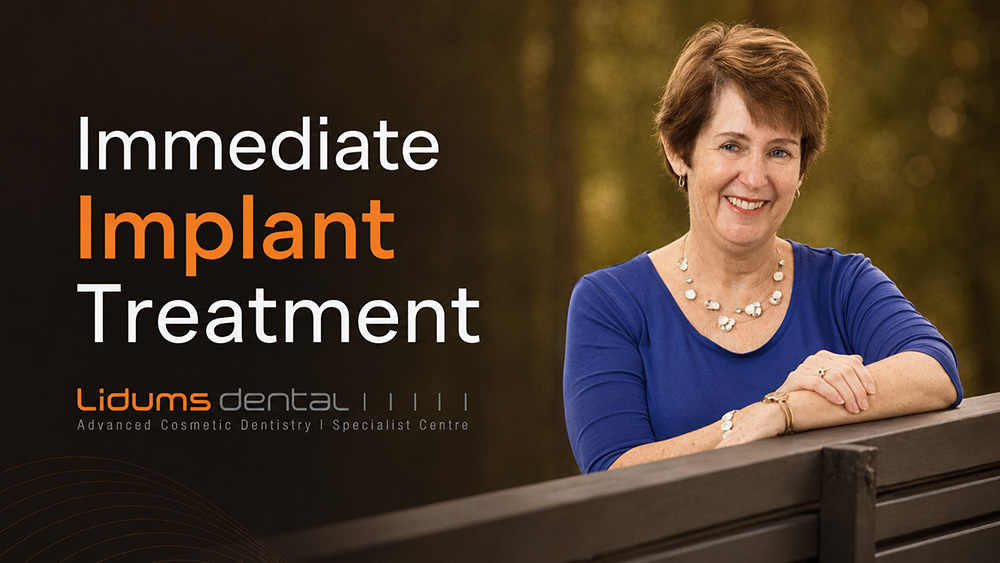 Get an immaculate smile with immediate implants! 1 immediate implant treatment