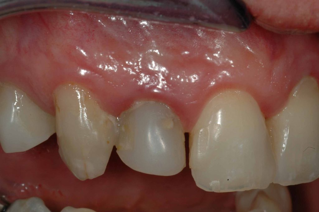 6-1-1024×681 6-1-1024x681