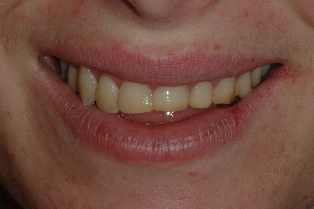 Afford-Nicole-2009.08.06-022-1024x681