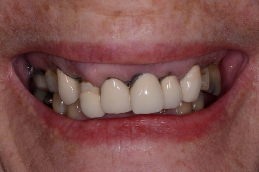 Alcock-Jennifer-2017.09.19-007-1024x683