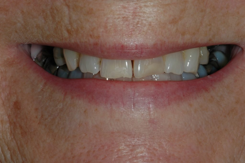 Crocker-Christine-2012.02.20-003-1024x681