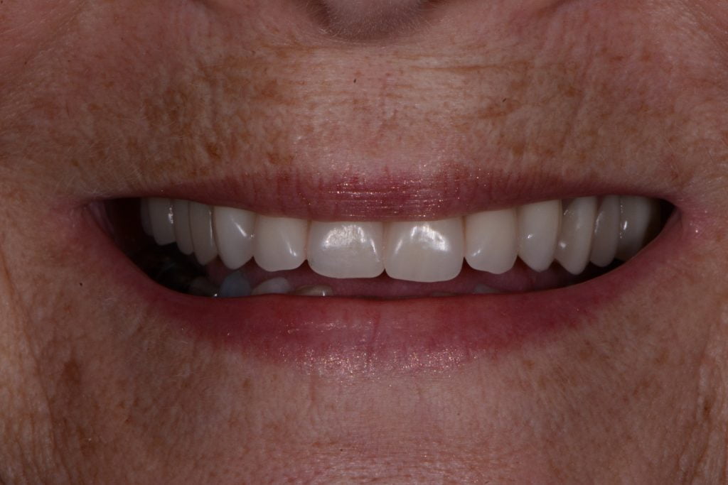 Croker-Christine-2014.27.08-103-1024x683