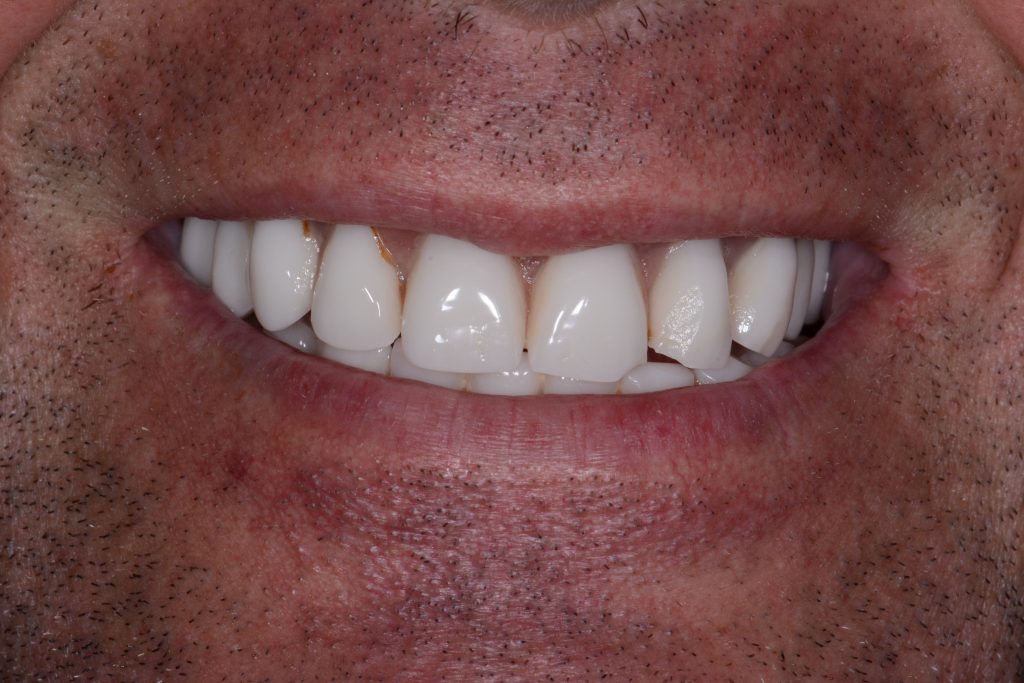 Long-David-2018.11.15-007-1024x683