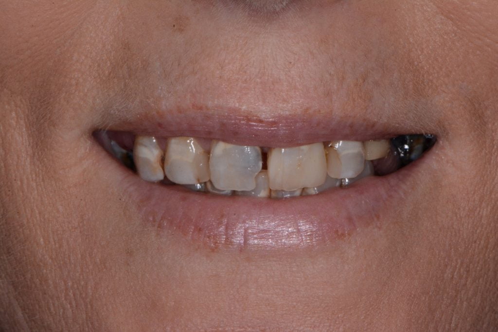 Plenty-Kylie-2016.11.22-0004-1024x683