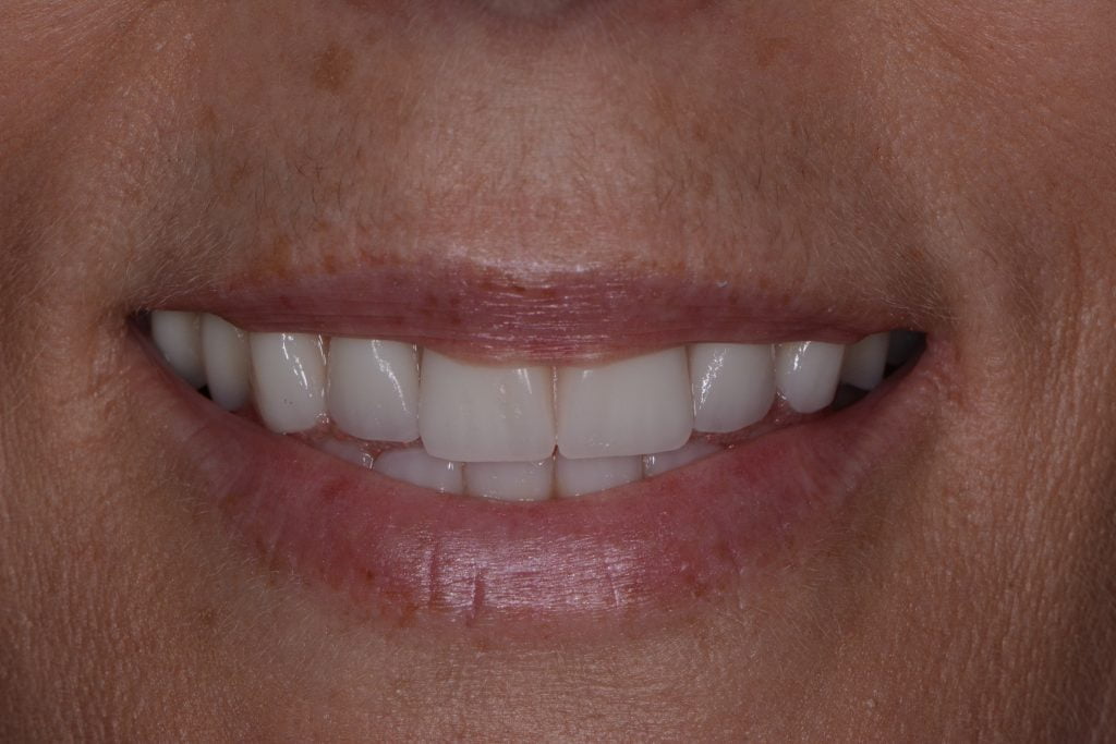 Plenty-Kylie-2017.11.27-005-1024x683