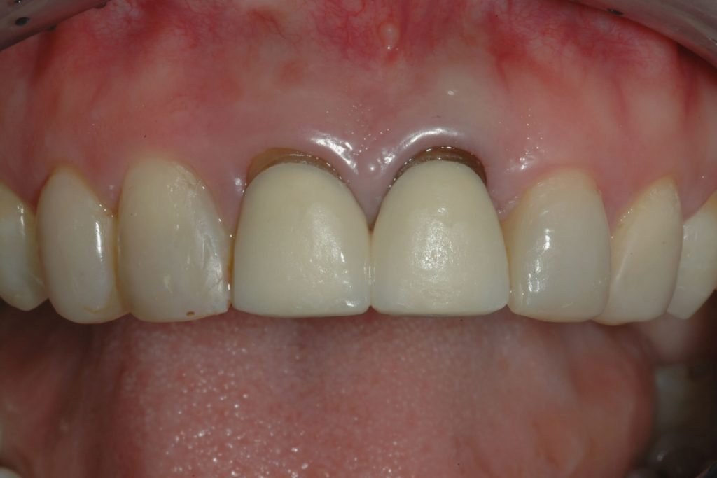 2-before-1-1024×683 2-before-1-1024x683