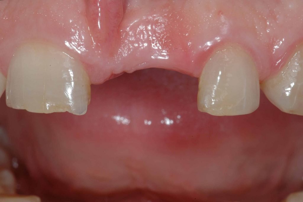 3-1-1024×683 3-1-1024x683