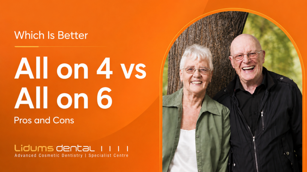 News & Articles 1 All on 4 vs all on 6 pros cons