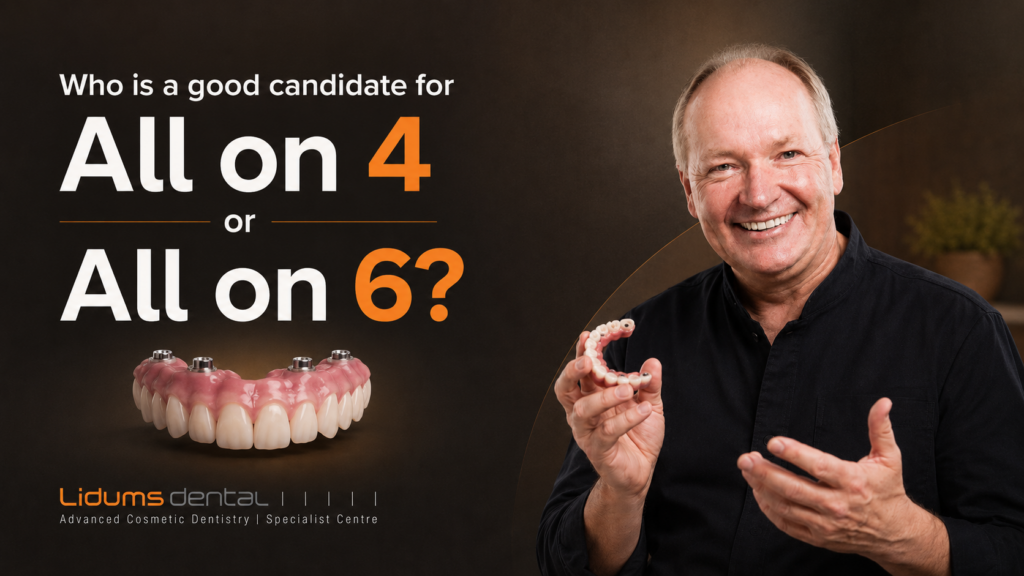 good candidate for all on 4 or 6