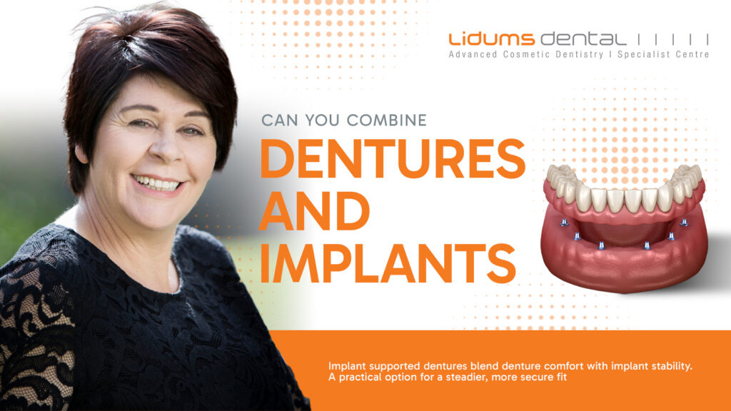 Dentures vs Implants: Which Tooth Replacement Option May Suit You? dentures and implants