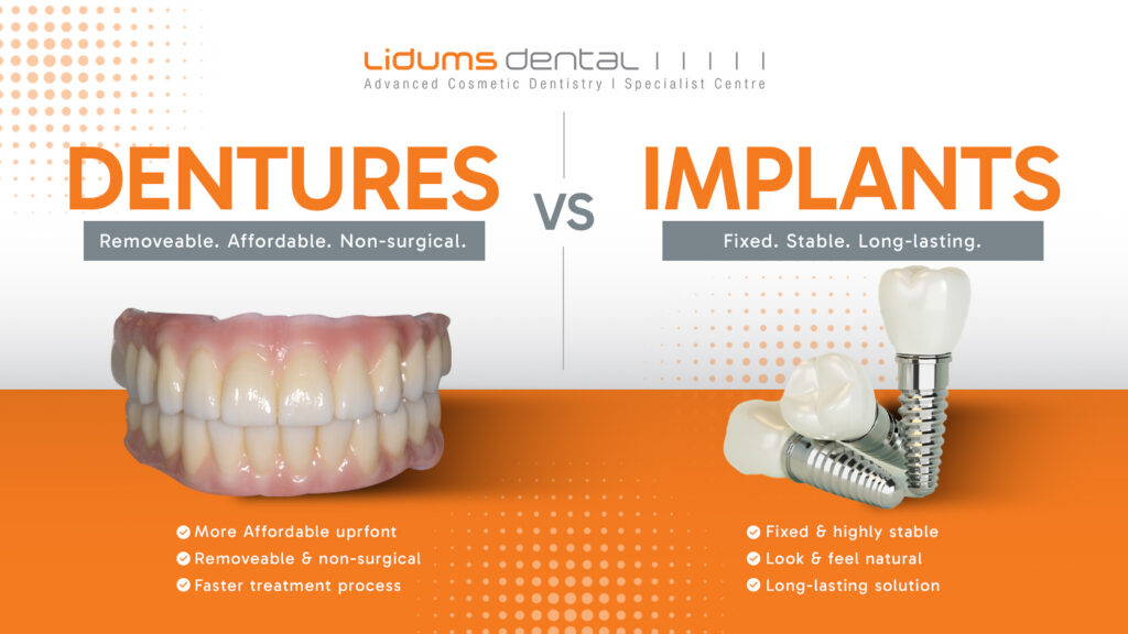 Dentures vs Implants: Which Tooth Replacement Option May Suit You? dentures vs implants
