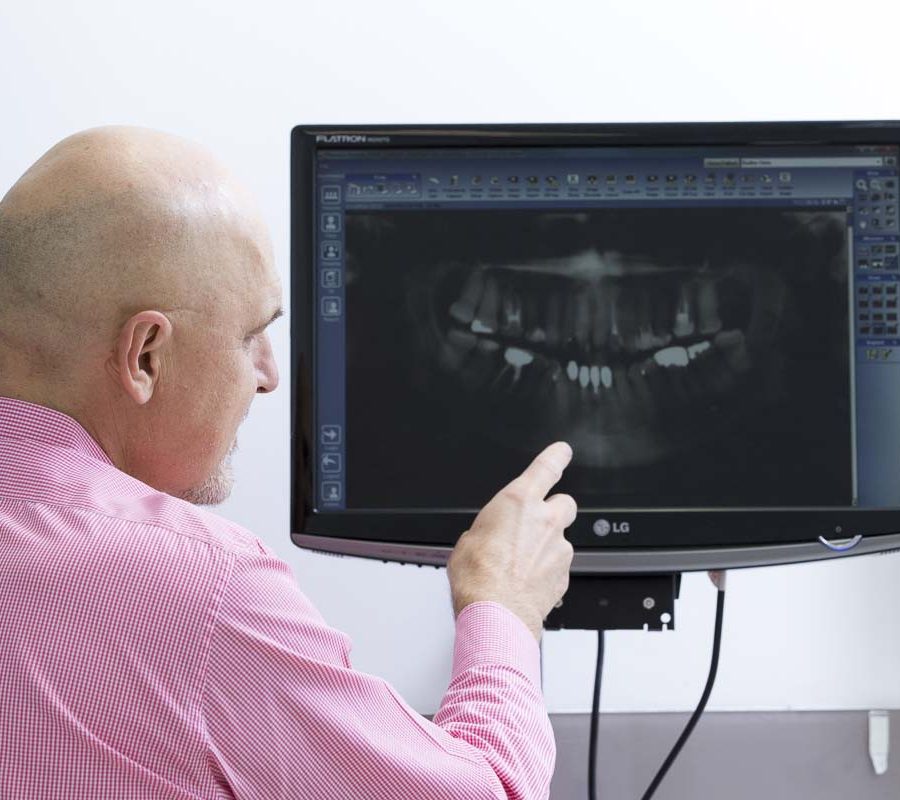 Arnis with OPG on screen