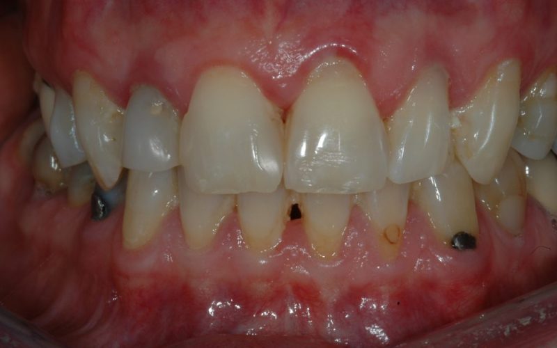 Rorison-Jeanette-2008.07.23-004-1024x681