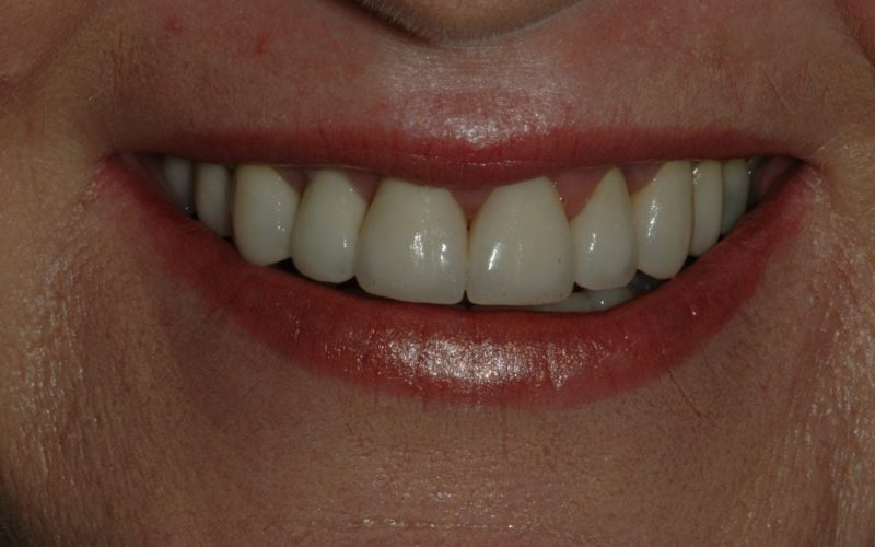 Rorison-Jeanette-2009.05.25-004-1024x681