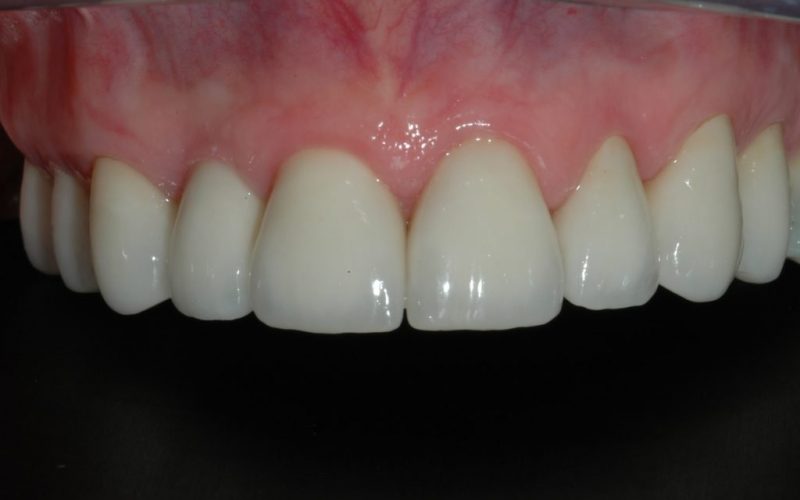 Rorison-Jeanette-2009.05.25-011-1024x681